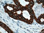 TNF alpha Antibody in Immunohistochemistry (Paraffin) (IHC (P))