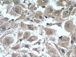 CYP2D6 Antibody in Immunohistochemistry (Paraffin) (IHC (P))