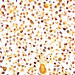 HIVgp160, gp120, gp41 Antibody in Immunocytochemistry (ICC/IF)