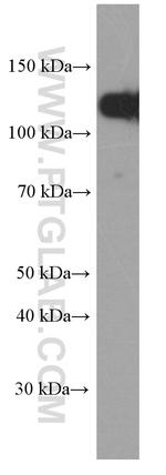 E-cadherin Antibody in Western Blot (WB)