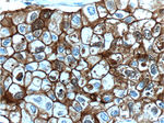 E-cadherin Antibody in Immunohistochemistry (Paraffin) (IHC (P))