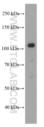 E-cadherin Antibody in Western Blot (WB)