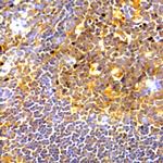 PD-L1 Antibody in Immunohistochemistry (Paraffin) (IHC (P))