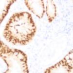 PARP (Poly (ADP-ribose) polymerase) Antibody in Immunohistochemistry (Paraffin) (IHC (P))