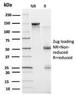 BCL6 Antibody in SDS-PAGE (SDS-PAGE)