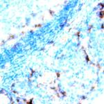 CD95L Antibody in Immunohistochemistry (Paraffin) (IHC (P))