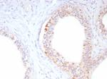 ROS1 Antibody in Immunohistochemistry (Paraffin) (IHC (P))