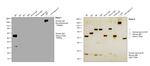 Human IgG (Gamma chain) Cross-Adsorbed Secondary Antibody in Western Blot (WB)