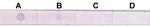 Acetyl-Histone H3 (Lys4) Antibody in Dot Blot (DB)