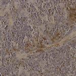 ADM2 Antibody in Immunohistochemistry (Paraffin) (IHC (P))