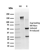 RXRB Antibody in SDS-PAGE (SDS-PAGE)