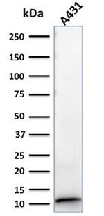 S100A2/S100 Calcium Binding Protein A2 Antibody in Western Blot (WB)