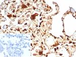 S100A11 (S100 calcium binding protein A11)/Calgizzarin Antibody in Immunohistochemistry (Paraffin) (IHC (P))