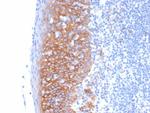 CD138/Syndecan-1 (SDC1) (Plasma Cell Marker) Antibody in Immunohistochemistry (Paraffin) (IHC (P))