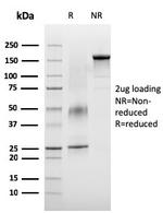 VISTA/B7-H5/VSIR (Negative Regulator of Immune Response) Antibody in SDS-PAGE (SDS-PAGE)