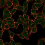 SCXA Antibody in Immunocytochemistry (ICC/IF)