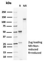 Pulmonary Surfactant-Associated Protein D (SFTPD) Antibody in SDS-PAGE (SDS-PAGE)