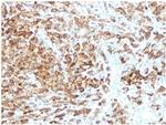 gp100/Melanosome/PMEL17/SILV (Melanoma Marker) Antibody in Immunohistochemistry (Paraffin) (IHC (P))