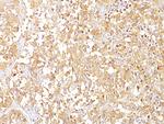 gp100/Melanosome/PMEL17/SILV (Melanoma Marker) Antibody in Immunohistochemistry (Paraffin) (IHC (P))