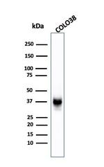 gp100/Melanosome/PMEL17/SILV (Melanoma Marker) Antibody in Western Blot (WB)