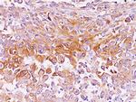 gp100/Melanosome/PMEL17/SILV (Melanoma Marker) Antibody in Immunohistochemistry (Paraffin) (IHC (P))