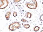 gp100/Melanosome/PMEL17/SILV (Melanoma Marker) Antibody in Immunohistochemistry (Paraffin) (IHC (P))