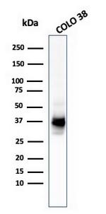 gp100/Melanosome/PMEL17/SILV (Melanoma Marker) Antibody in Western Blot (WB)