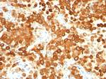 gp100/Melanosome/PMEL17/SILV (Melanoma Marker) Antibody in Immunohistochemistry (Paraffin) (IHC (P))