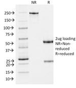 gp100/Melanosome/PMEL17/SILV (Melanoma Marker) Antibody in SDS-PAGE (SDS-PAGE)