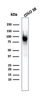 gp100/Melanosome/PMEL17/SILV (Melanoma Marker) Antibody in Western Blot (WB)