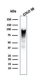 gp100/Melanosome/PMEL17/SILV Antibody in Western Blot (WB)