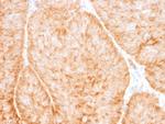 GLUT-1 Antibody in Immunohistochemistry (Paraffin) (IHC (P))