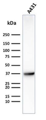 GLUT-1 Antibody in Western Blot (WB)