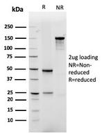 GLUT-1 (Tumor Progression and Mesothelioma Marker) Antibody in SDS-PAGE (SDS-PAGE)