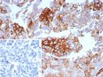 GLUT-1 (Tumor Progression and Mesothelioma Marker) Antibody in Immunohistochemistry (Paraffin) (IHC (P))