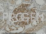 Synaptopodin Antibody in Immunohistochemistry (IHC)