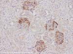 Synaptopodin Antibody in Immunohistochemistry (IHC)