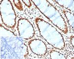 BRG1/SMARCA4 Antibody in Immunohistochemistry (Paraffin) (IHC (P))