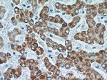 TST Antibody in Immunohistochemistry (Paraffin) (IHC (P))