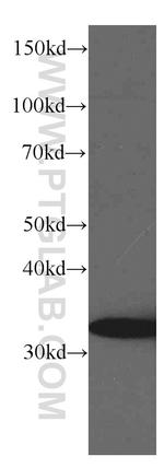 TST Antibody in Western Blot (WB)