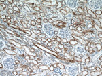 TST Antibody in Immunohistochemistry (Paraffin) (IHC (P))