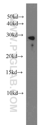 TST Antibody in Western Blot (WB)