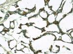 UBE2C Antibody in Immunohistochemistry (Paraffin) (IHC (P))