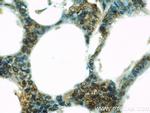 UBE2C Antibody in Immunohistochemistry (Paraffin) (IHC (P))