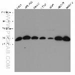 UBE2C Antibody in Western Blot (WB)
