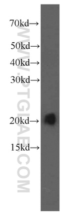 UBE2C Antibody in Western Blot (WB)