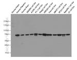 Lamin B1 Antibody in Western Blot (WB)