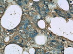 Clusterin Antibody in Immunohistochemistry (Paraffin) (IHC (P))