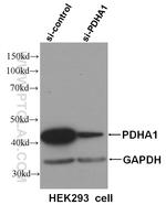 PDH E1 alpha Antibody in Western Blot (WB)
