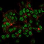 SUMO-2/3 Antibody in Immunocytochemistry (ICC/IF)